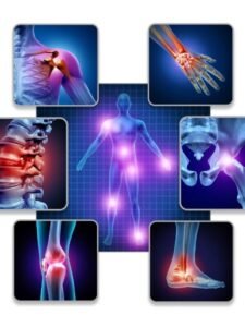 Que fazer para Melhorar as articulações quando chegar na 3 idade