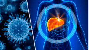 O que é hepatite viral uma visão detalhada e abrangente